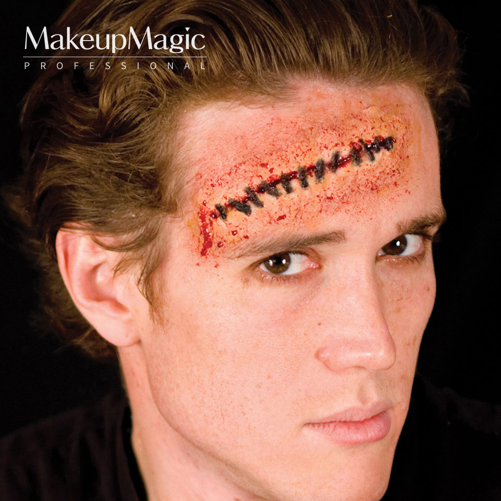 Stitches 꿰맨 상처 148